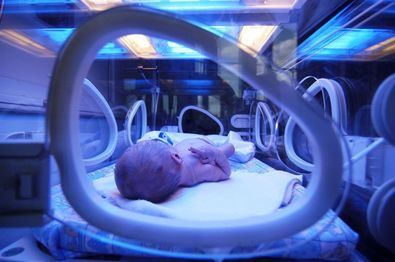 El objetivo de este programa es mejorar el pronóstico y los cuidados y reducir las secuelas de los bebés ingresados en las UCI's neonatales, fundamentalmente bebés prematuros y aquellos que presentan patologías graves al nacer.