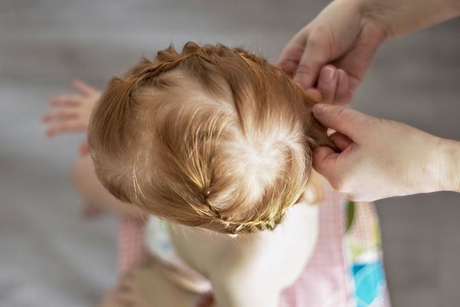 Este tipo de alopecia se origina por la tirantez prolongada sobre el cuero cabelludo de peinados tirantes, trenzas o extensiones, así como por la utilización de accesorios como gomas, cintas o diademas que aprietan según los expertos de Hospital Capilar.